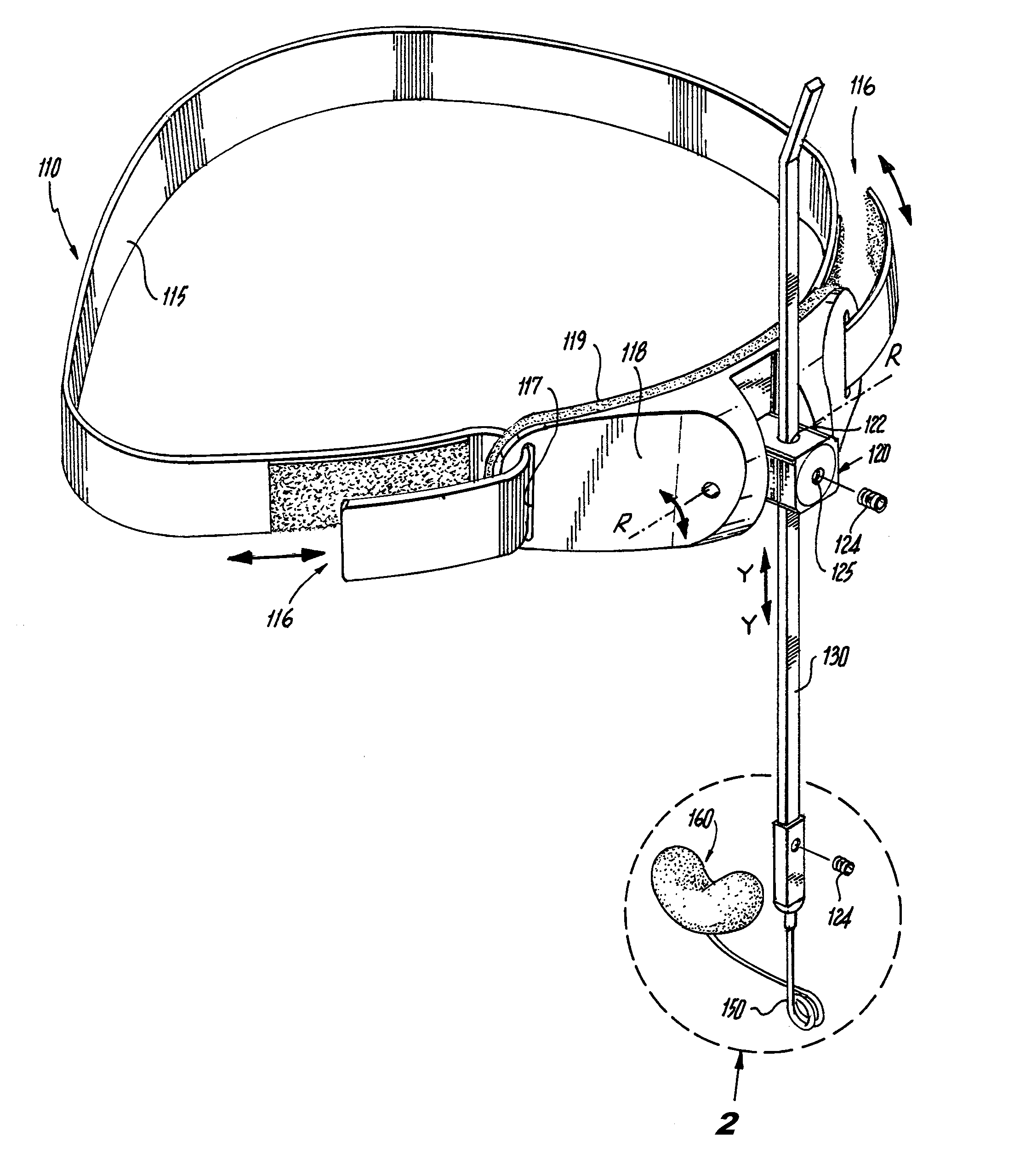 Extraoral Nasal Molding Headgear Device for the Treatment of Cleft Lip and Palate