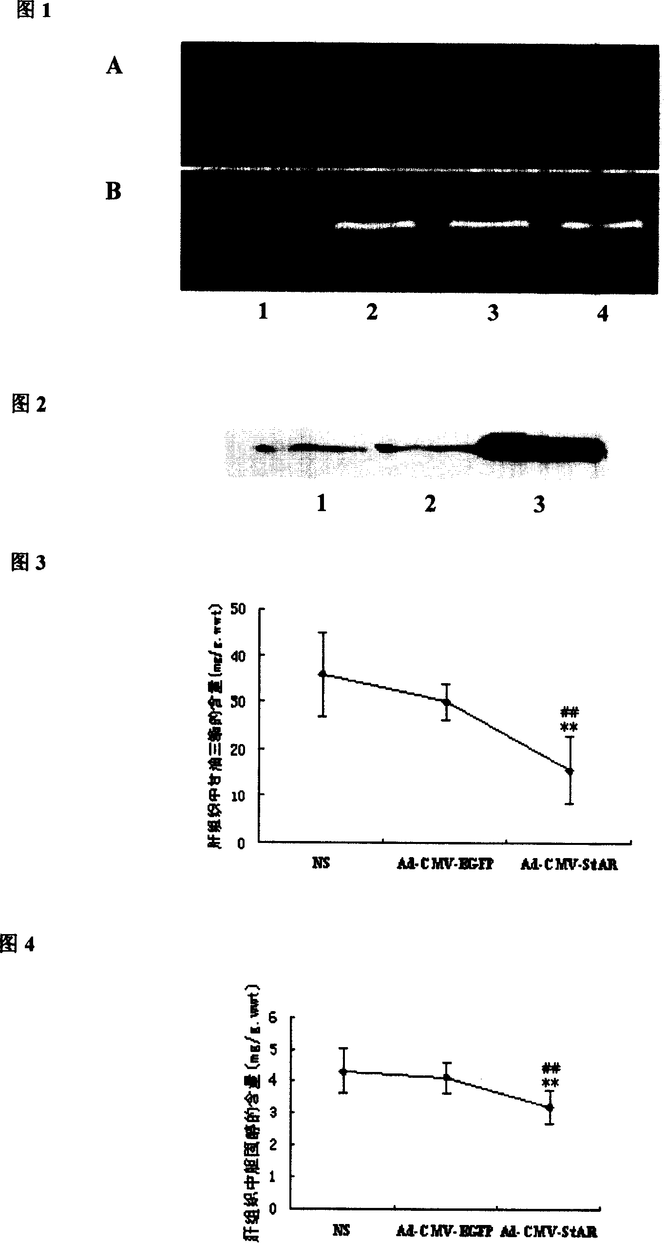 Use of steroid hormone synthesized acute regulation protein in the preparation of medicament for preventing and controlling fatty liver