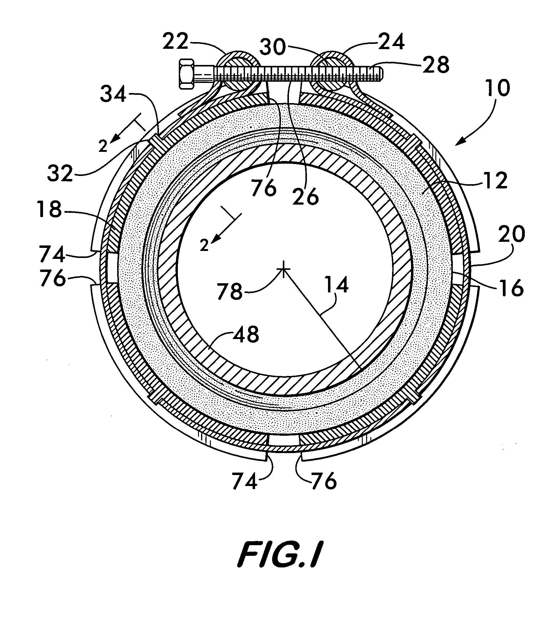 Pipe coupling having compression band