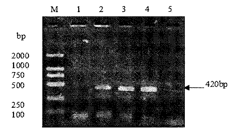 Genotype inspection method and genotyping inspection method of staphylococcal enterotoxin