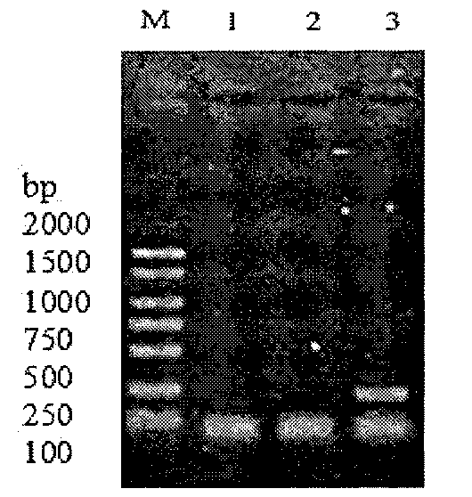 Genotype inspection method and genotyping inspection method of staphylococcal enterotoxin