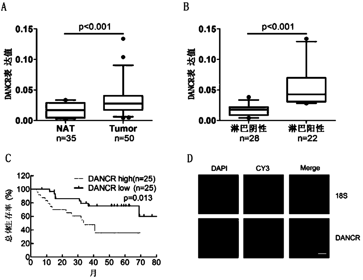 Molecular marker LncRNA DANCR for diagnosing and treating bladder cancer and application thereof