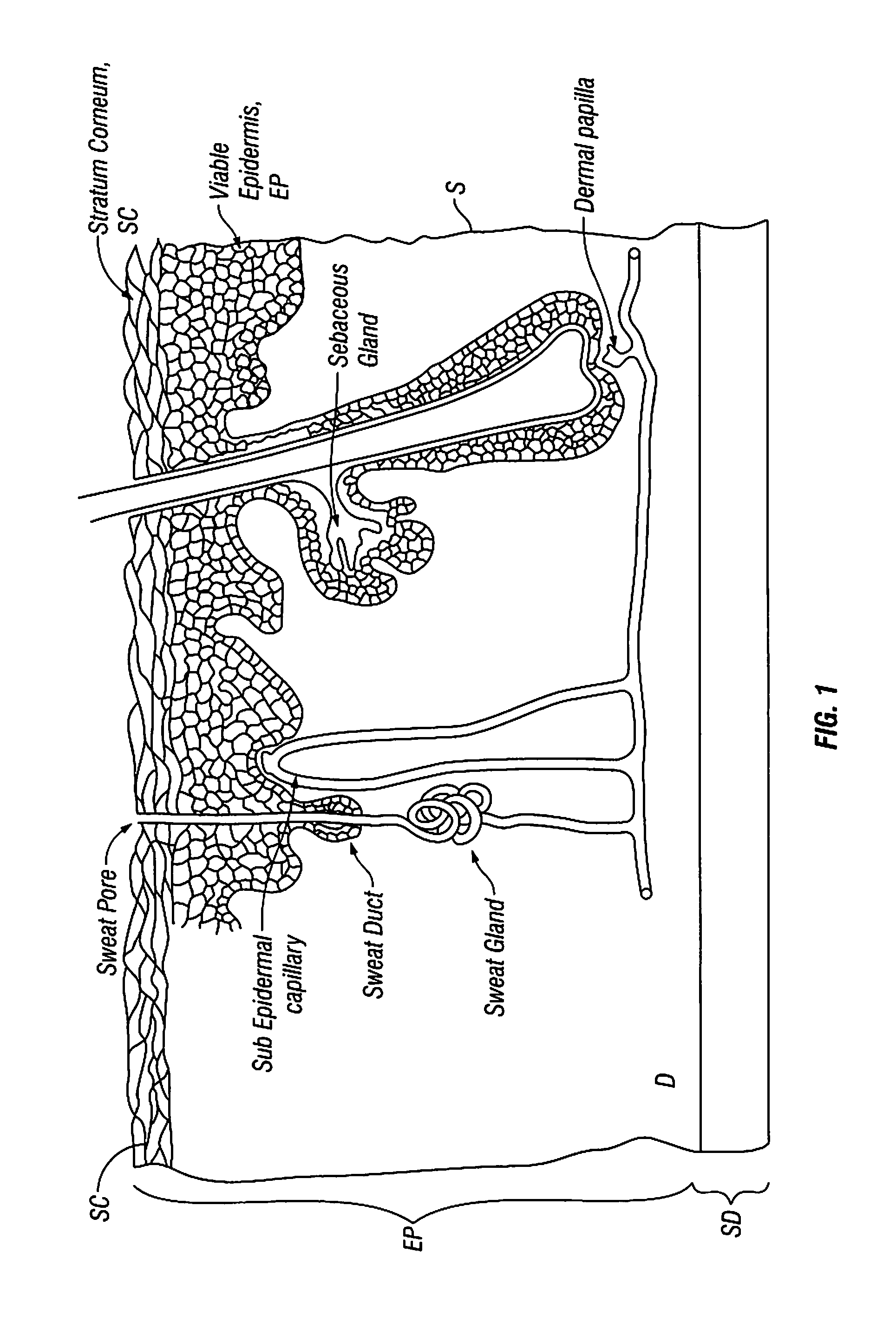 Patches and Methods for the Transdermal Delivery of Agents to Treat Hair Loss