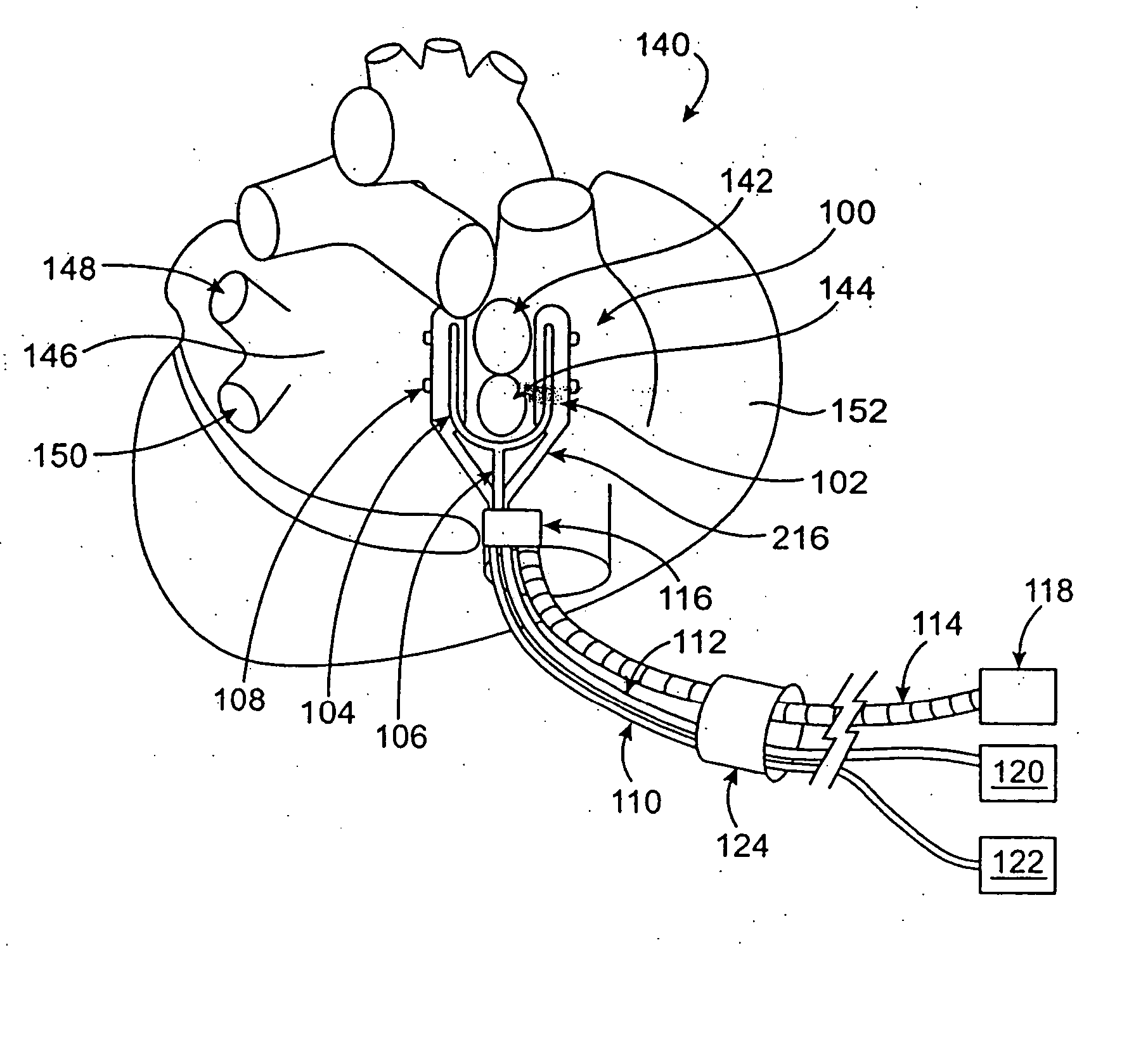 Cardiac ablation devices and methods