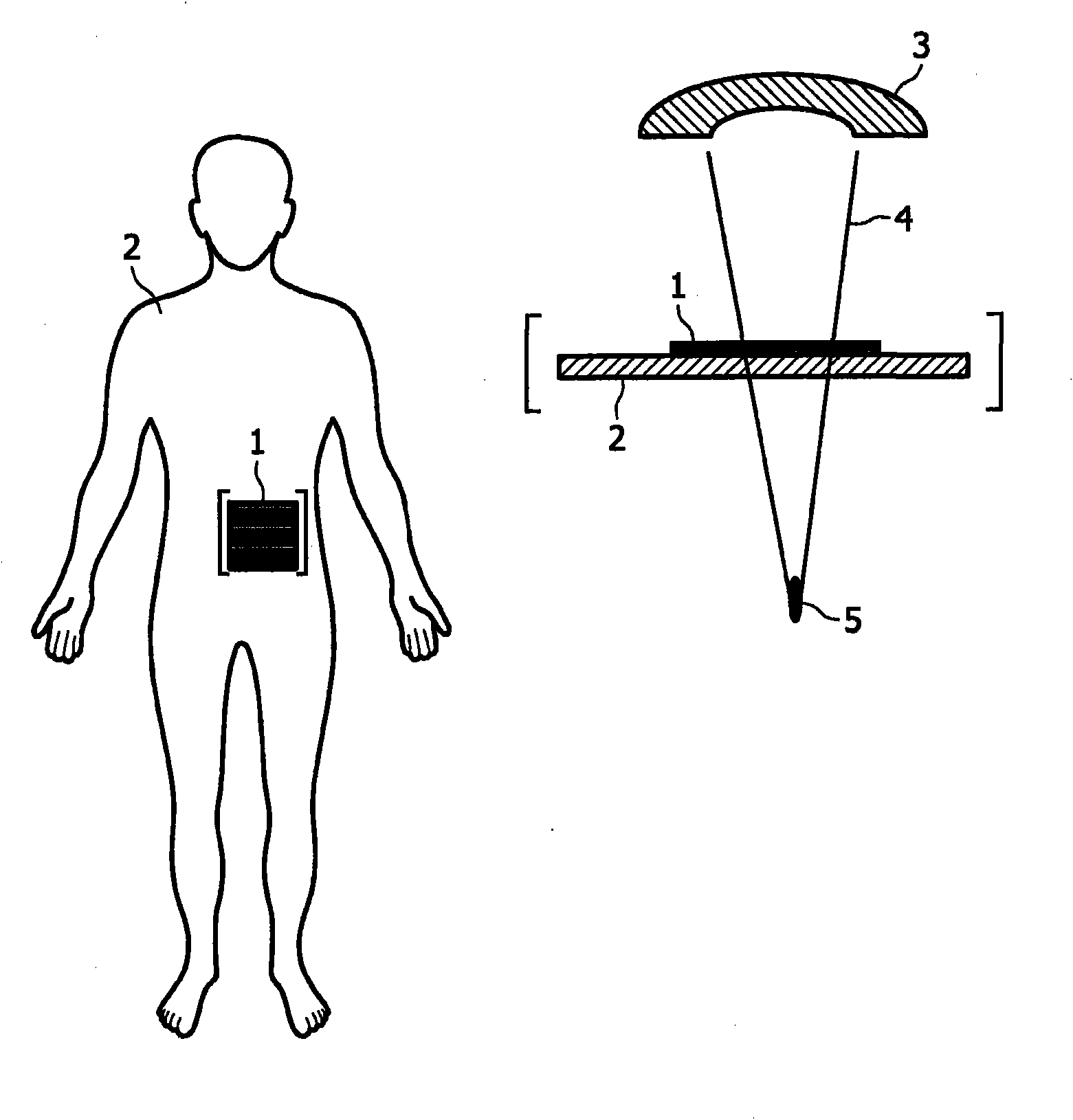 Tissue temperature indicating element for ultrasound therapy