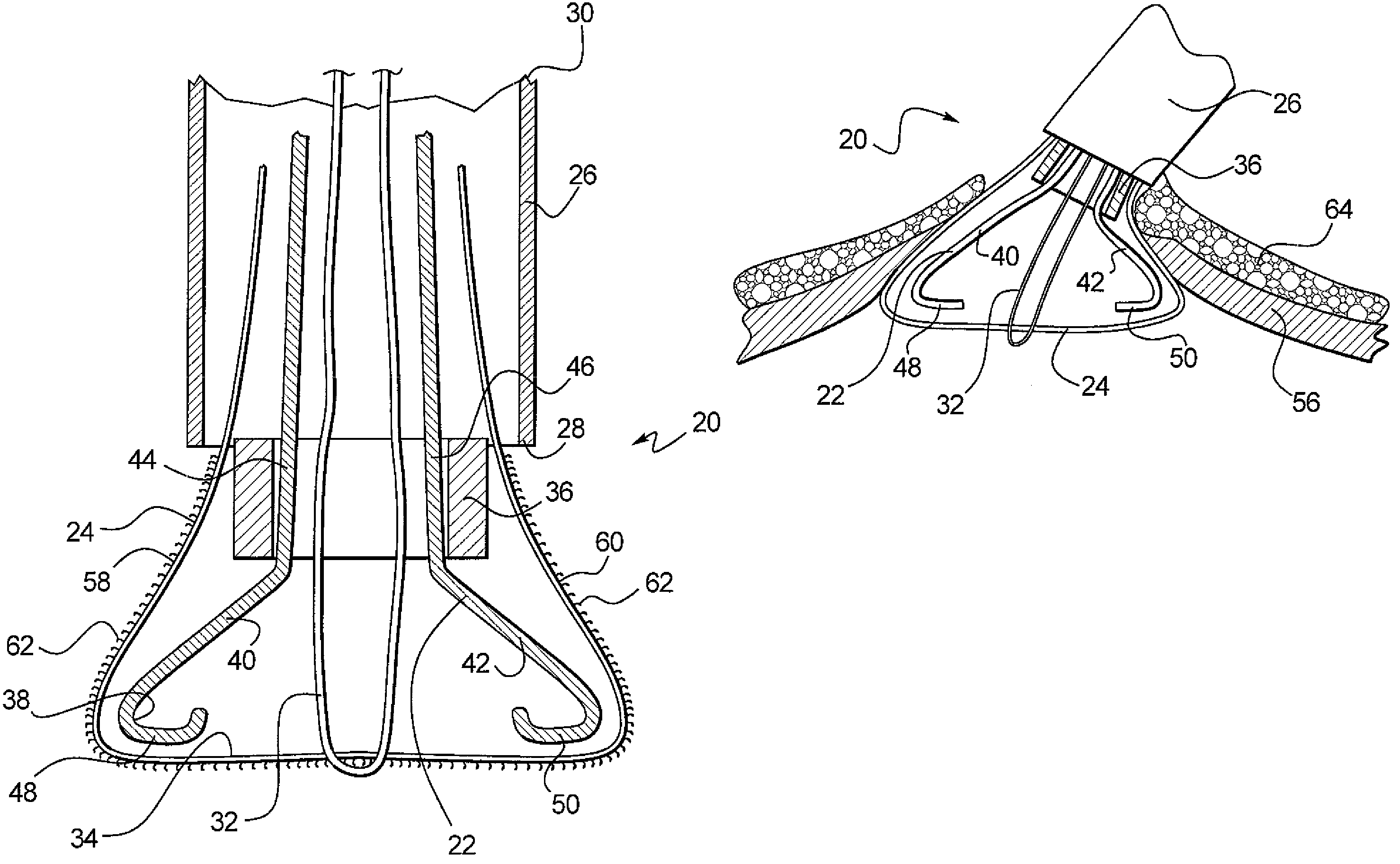 Connective tissue closure device and method