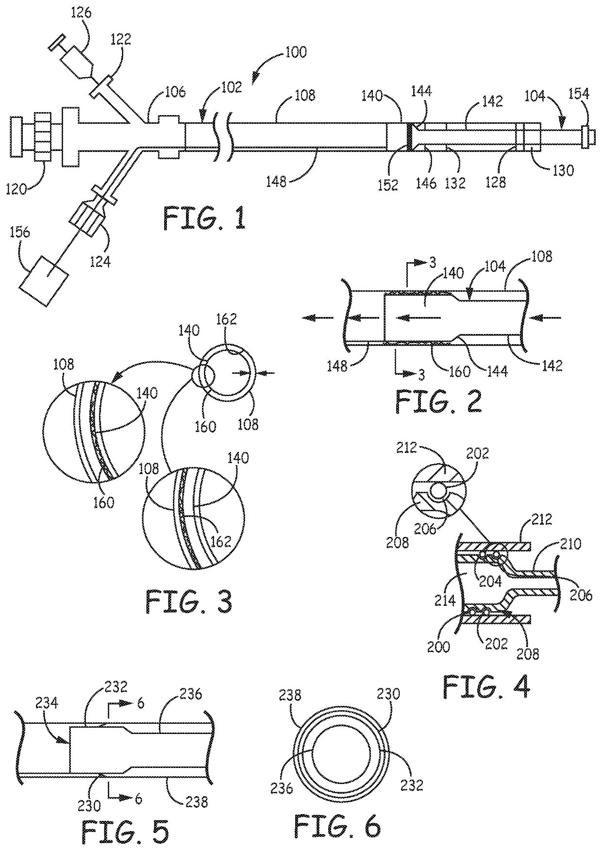 Catheter systems for applying effective suction in remote vessels and thrombectomy procedures facilitated by catheter systems