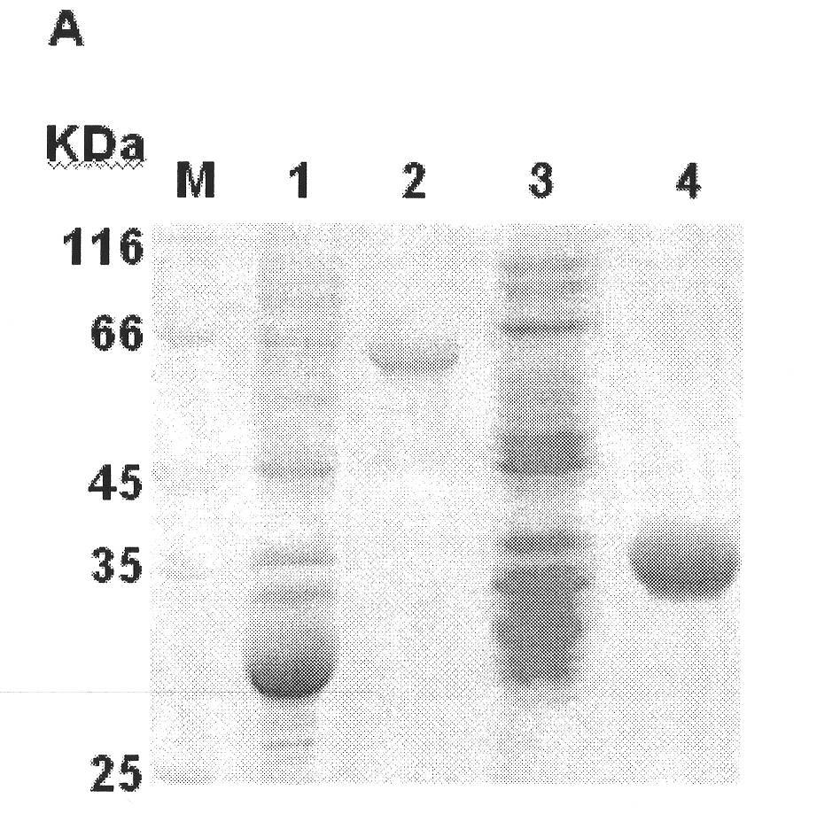 Xinjiang hemorrhagic fever virus nucleoprotein antigen gene as well as recombinant protein and application thereof