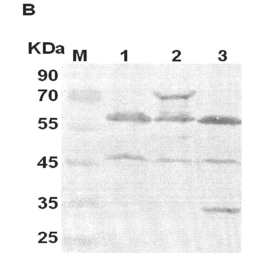 Xinjiang hemorrhagic fever virus nucleoprotein antigen gene as well as recombinant protein and application thereof