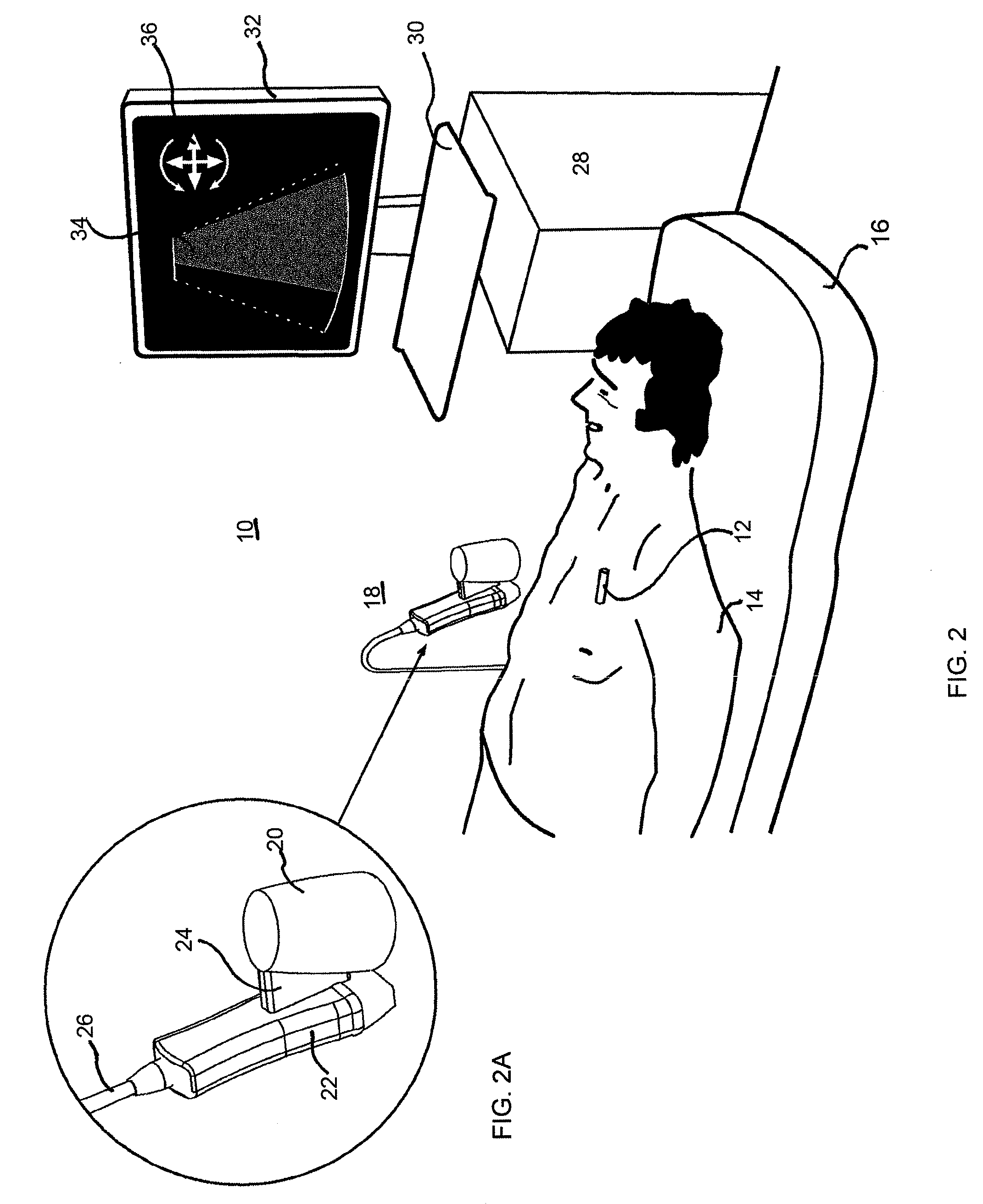 Location tracking of a metallic object in a living body using a radar detector and guiding an ultrasound probe to direct ultrasound waves at the location