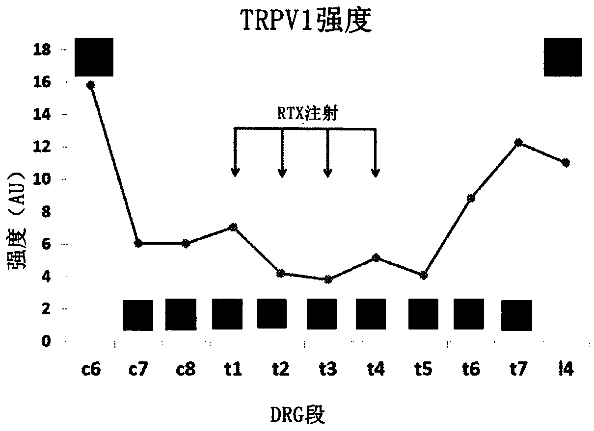 Methods for administration and methods for treating cardiovascular diseases with resiniferatoxin