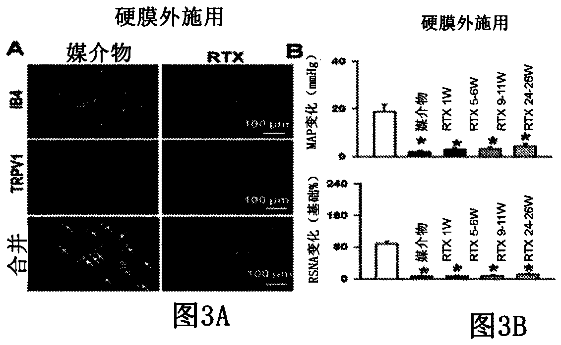 Methods for administration and methods for treating cardiovascular diseases with resiniferatoxin