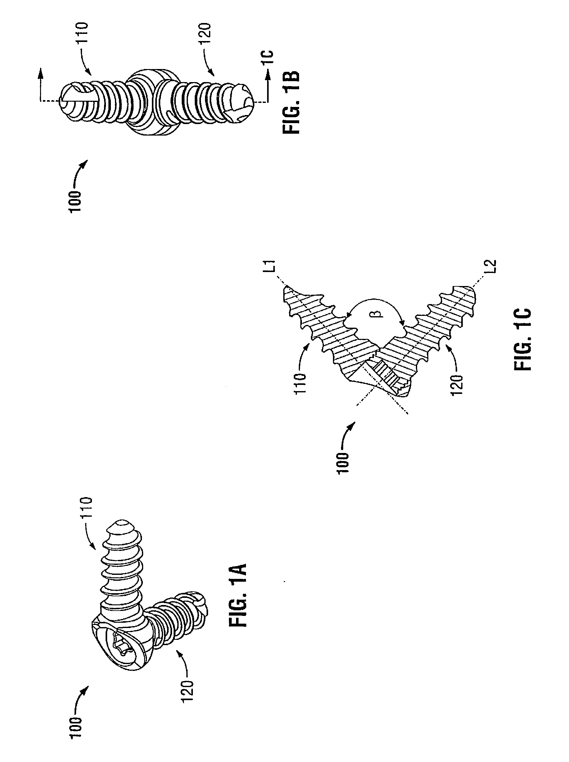 Bone screw assembly