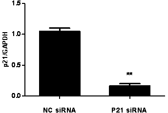 SiRNA (Ribonucleic Acid) for specifically inhibiting p21 gene expression and application thereof