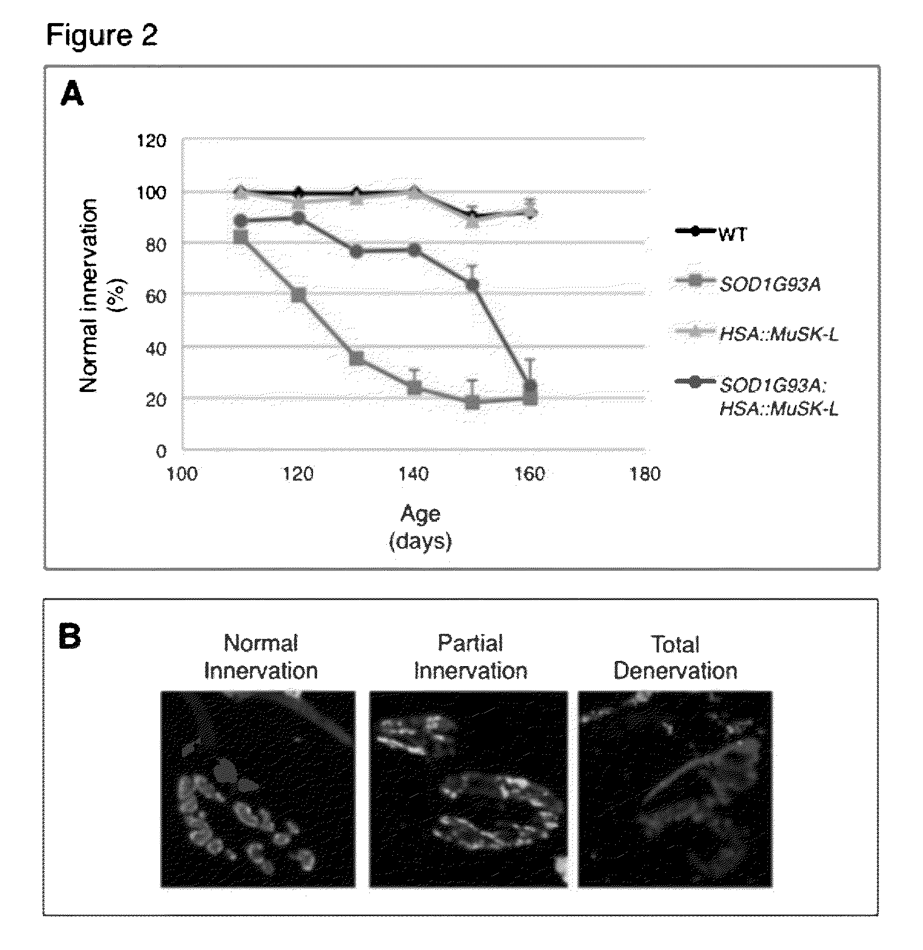 Method of treating motor neuron disease with an antibody that agonizes MuSK