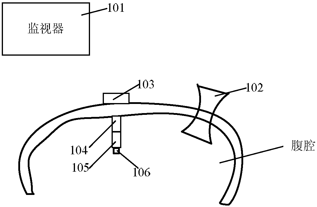 Peritoneoscope