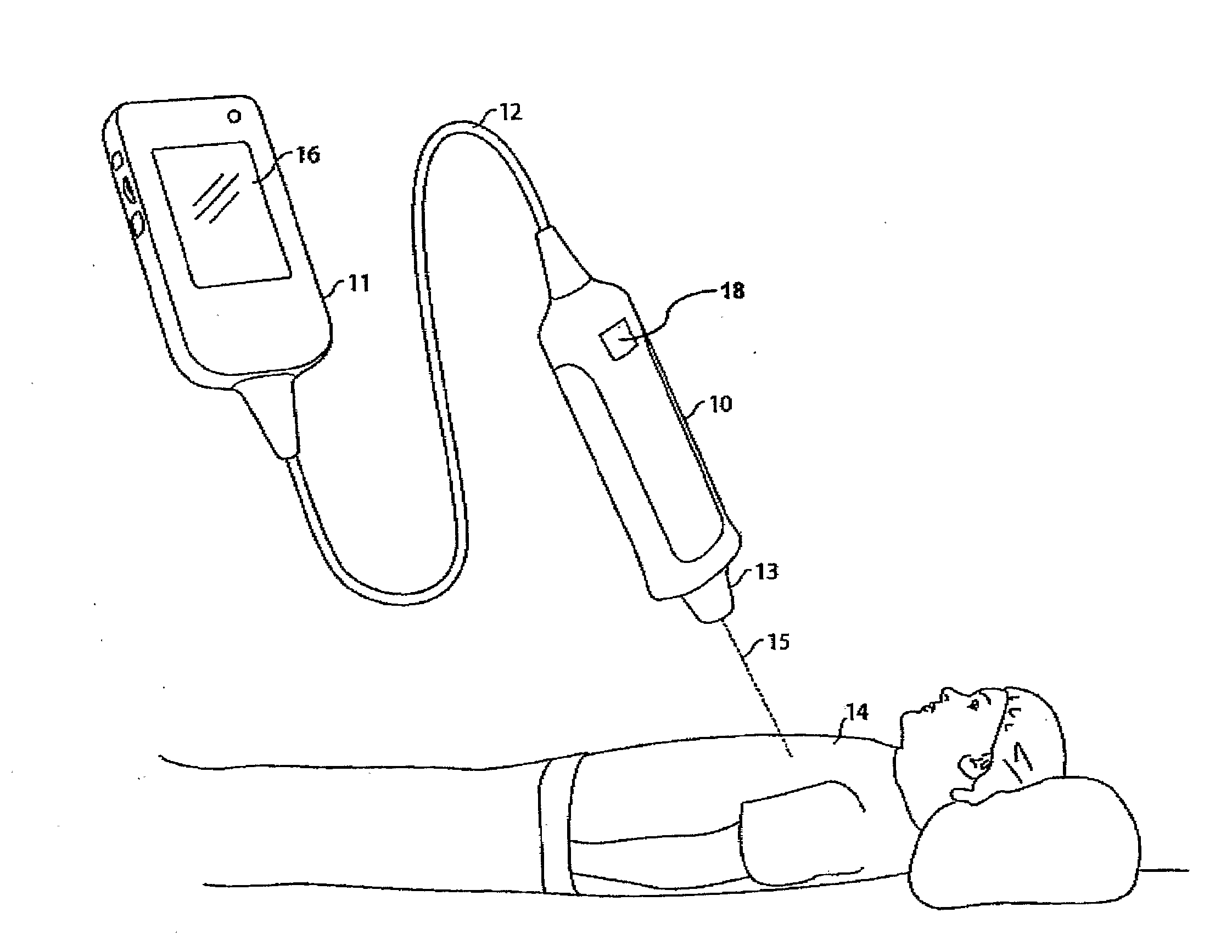 Medical scanning apparatus and method