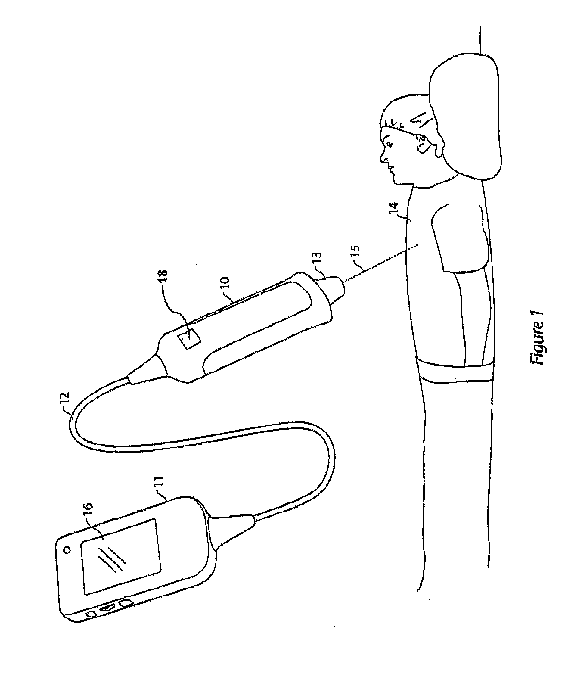 Medical scanning apparatus and method