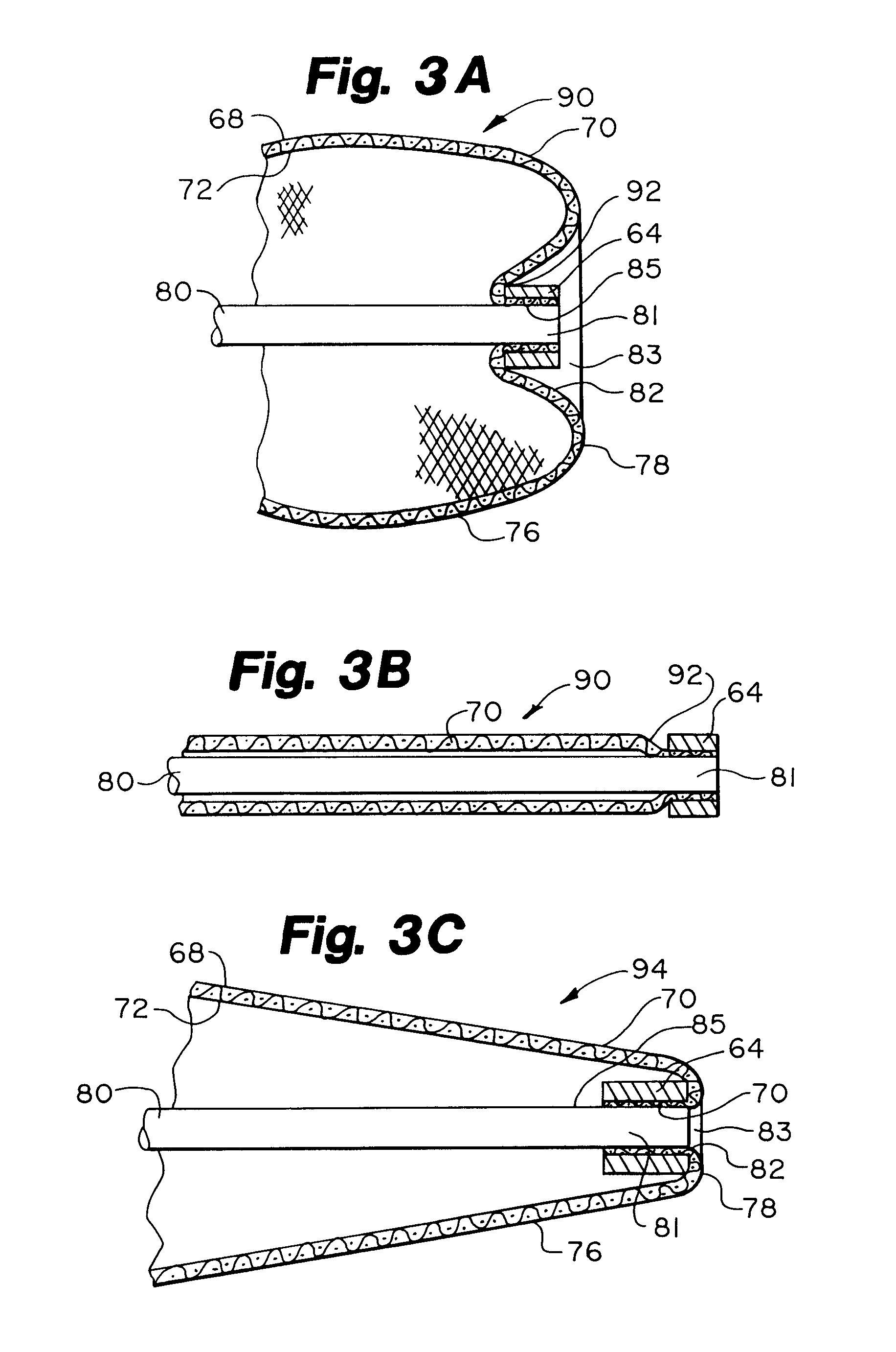Everted filter device