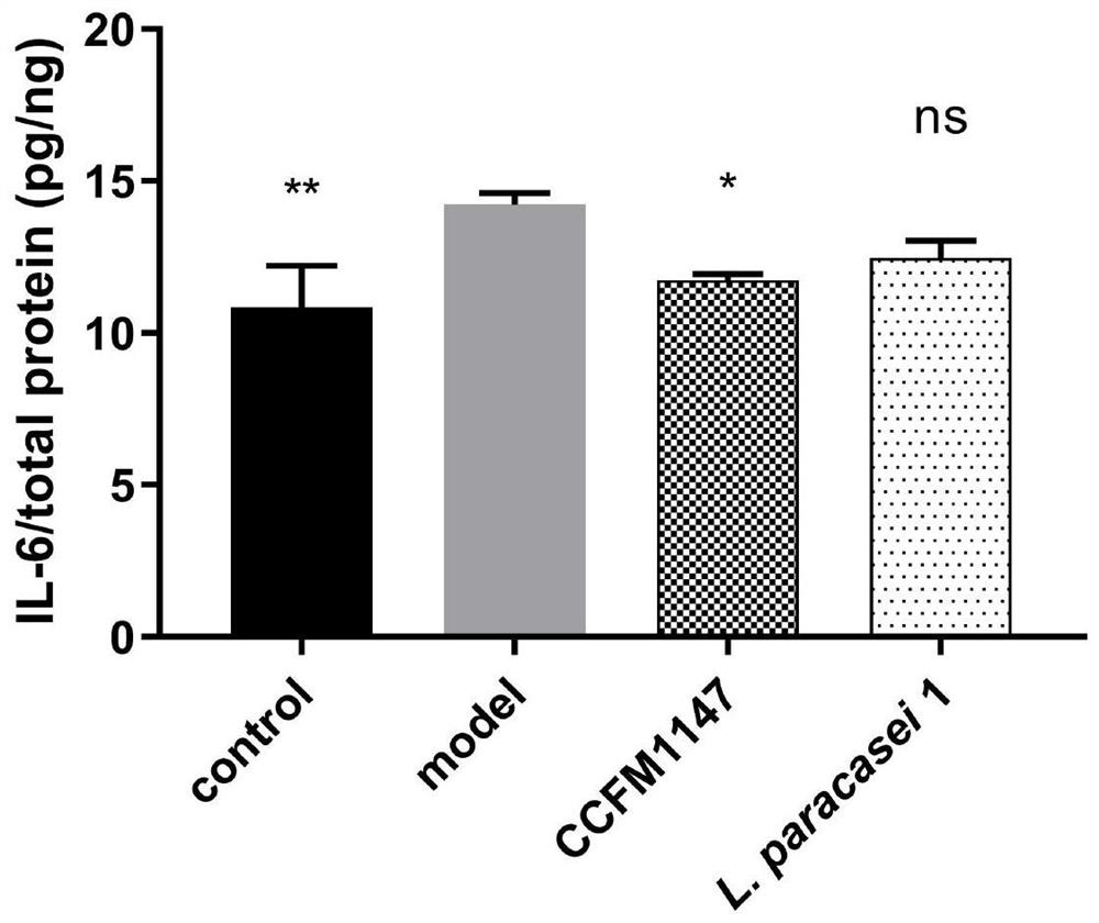 A strain of Lactobacillus paracasei that can inhibit the abnormal proliferation of hacat cells