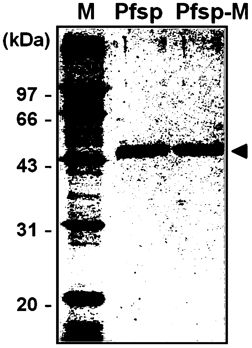 A protease with improved high-temperature activity and thermal stability, its preparation method and application