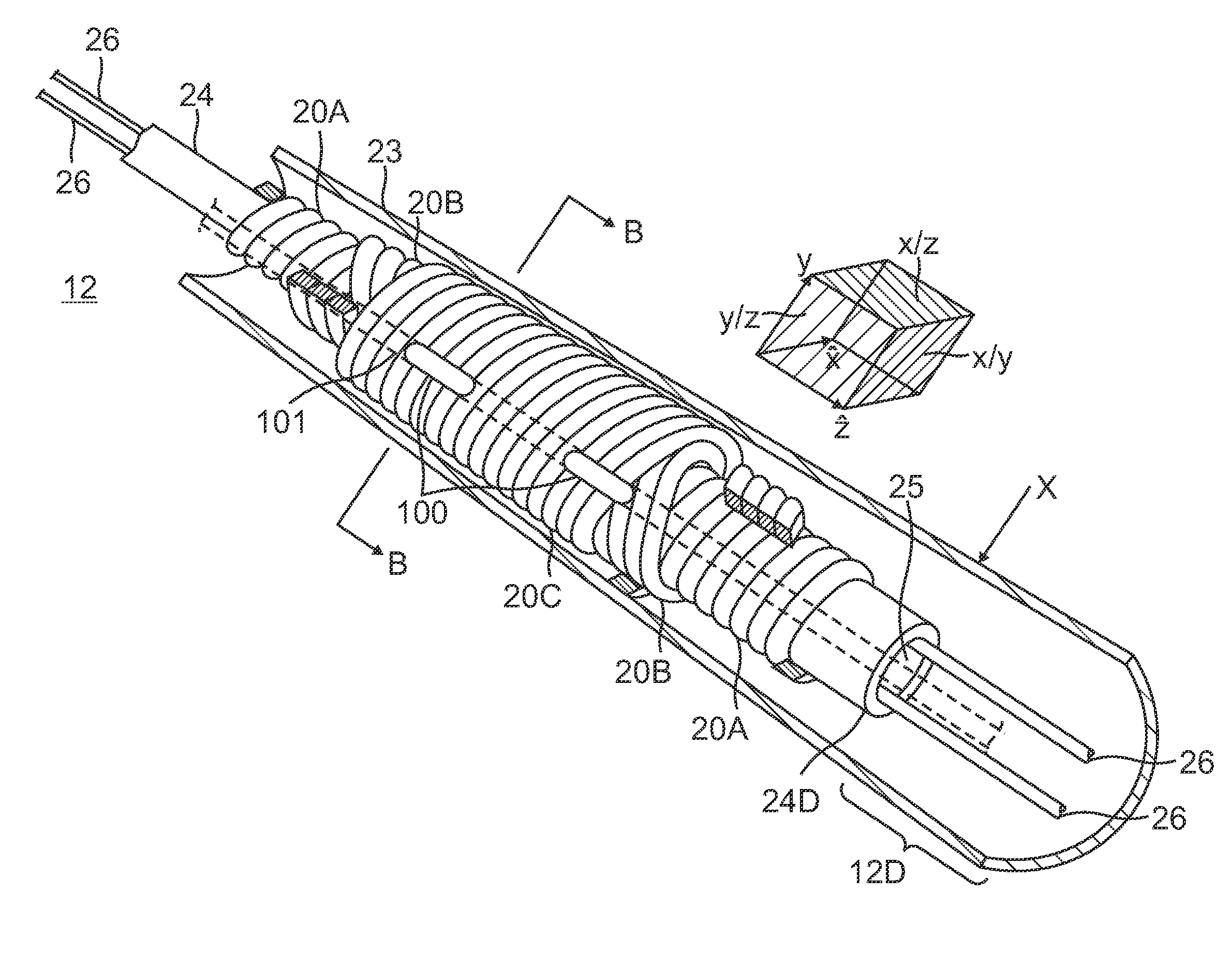 Catheter with adjustable deflection