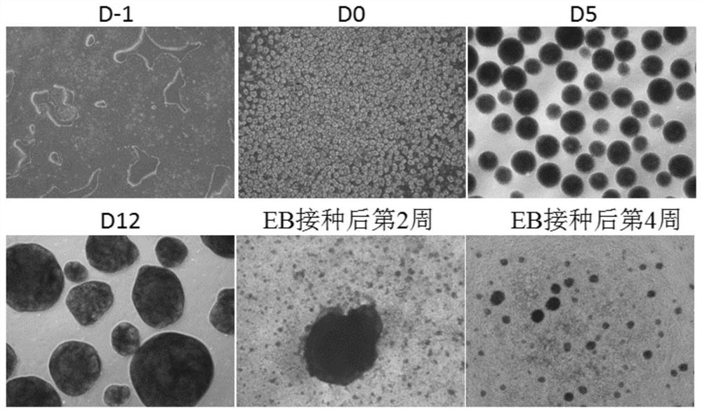 A method and application of differentiating human pluripotent stem cells into natural killer cells