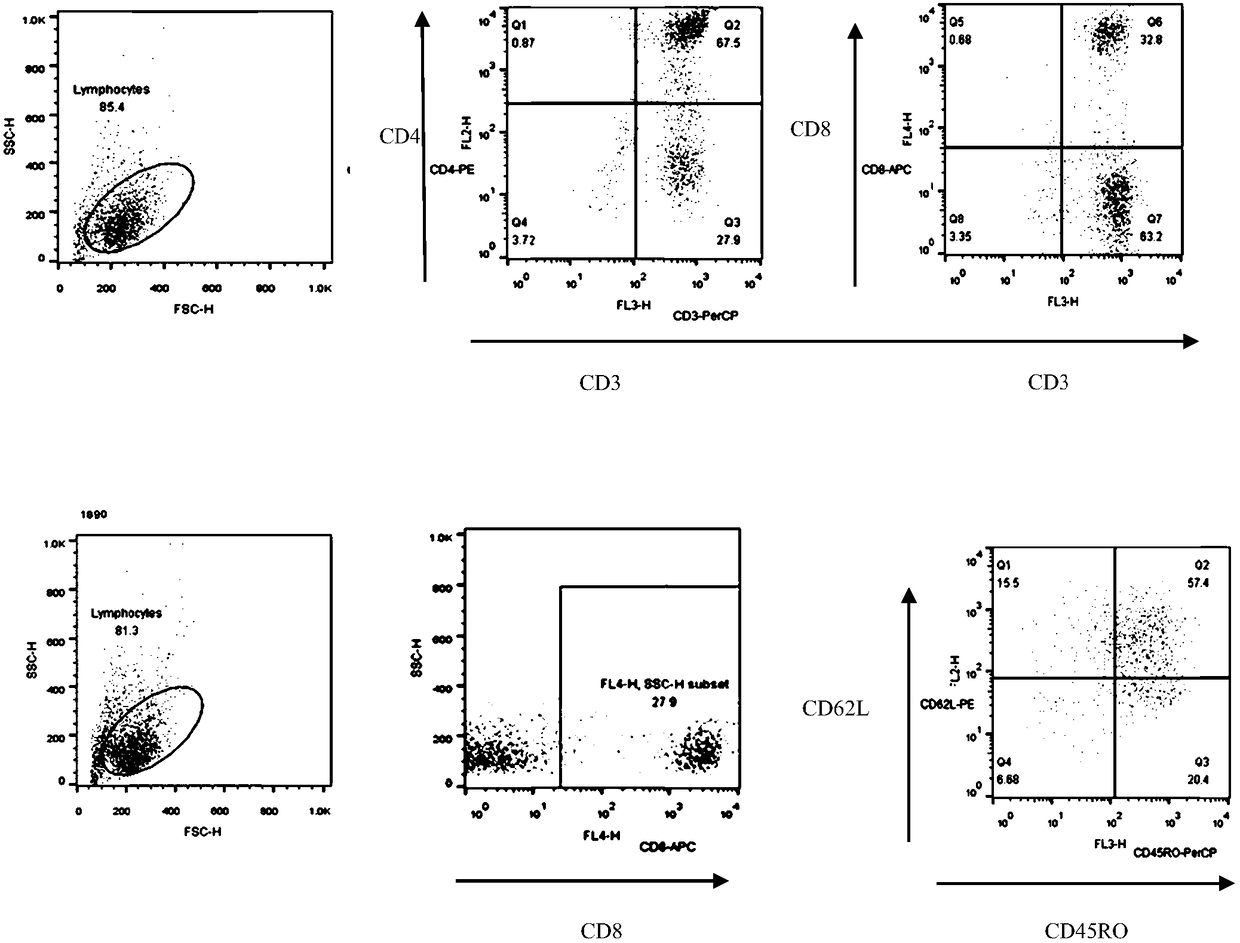 Human T lymphocytes carrying CD20/CD19 bispecific chimeric antigen receptor as well as preparation method and application of human T lymphocytes
