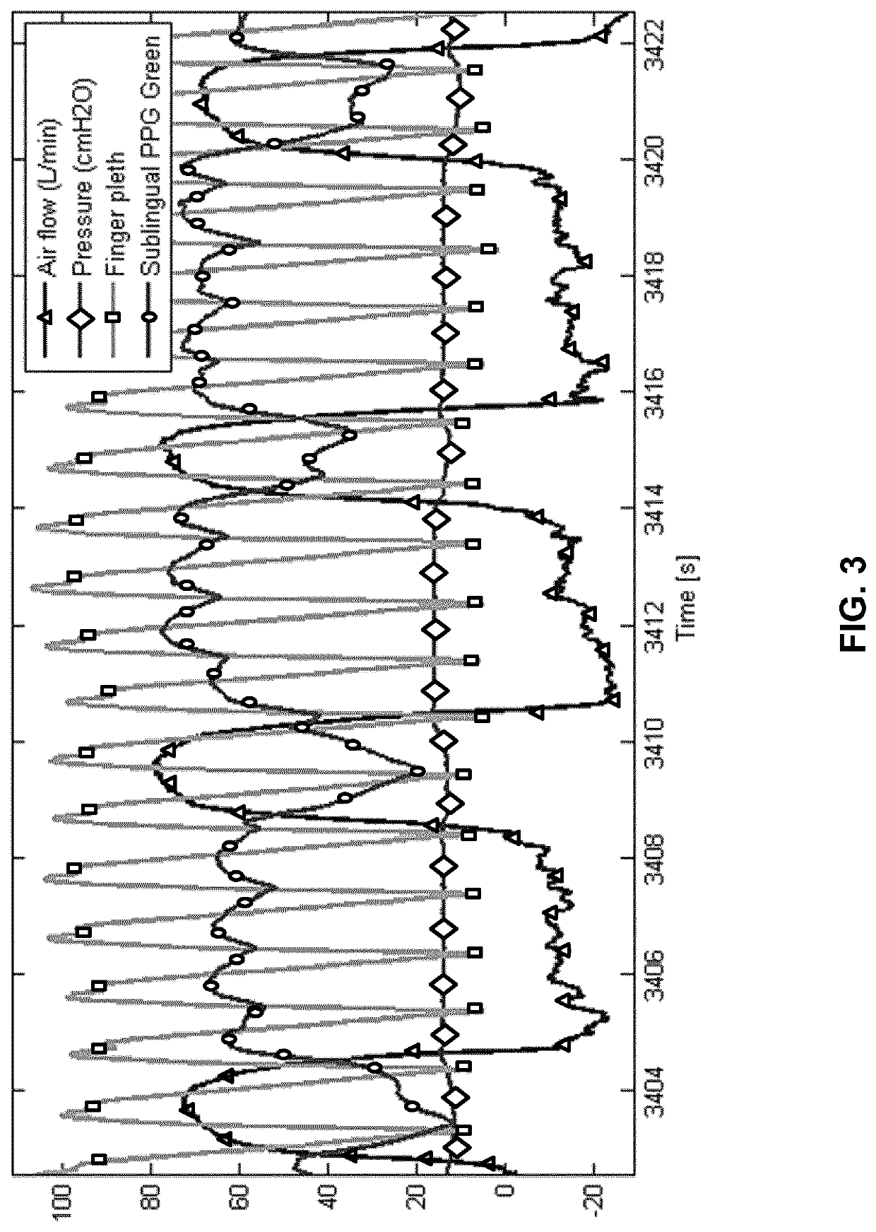 Patient monitoring