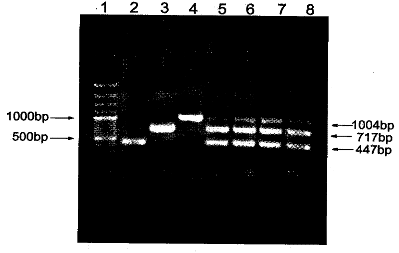 Method for detecting Francisella tularensis using multiple PCR technology