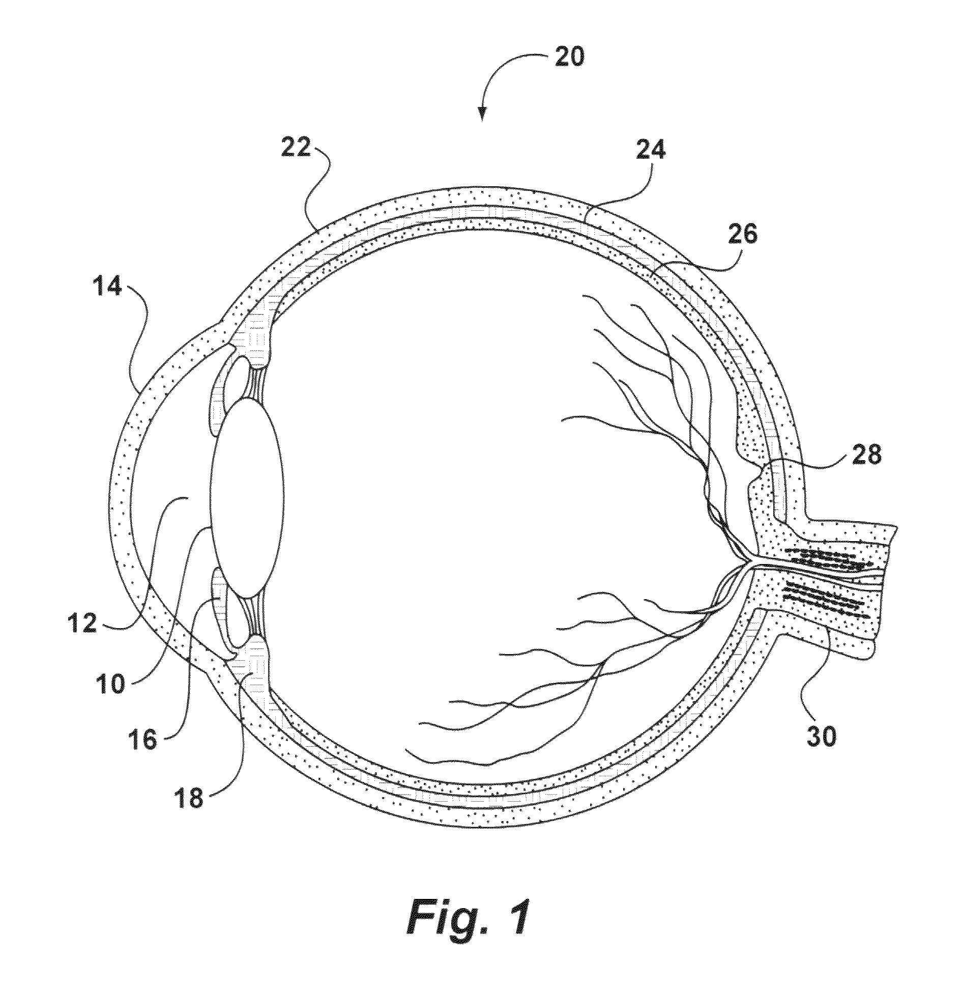 System and method for storing, shipping and injecting ocular devices