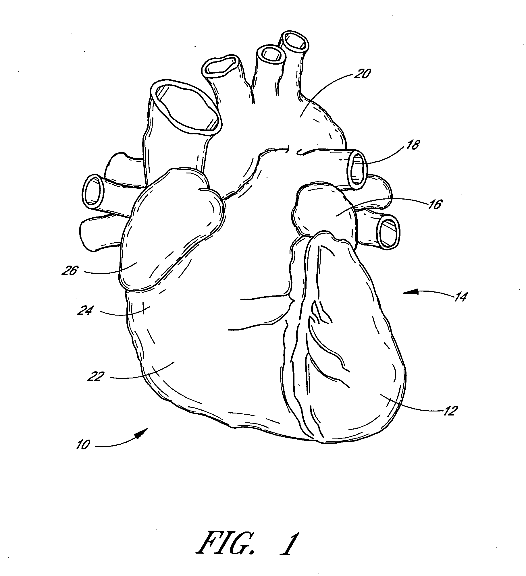 Method of closing an opening in a wall of the heart