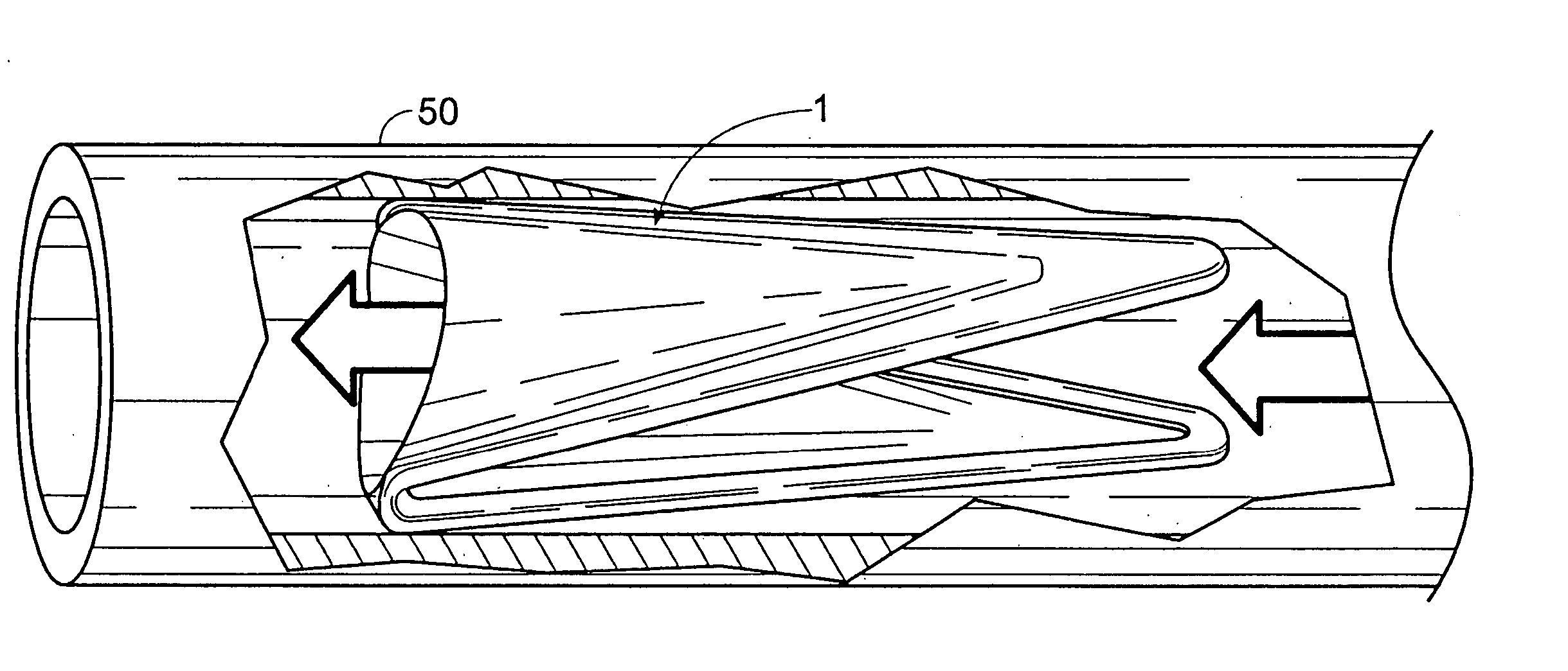 Method for suturelessly attaching a biomaterial to an implantable bioprosthesis frame