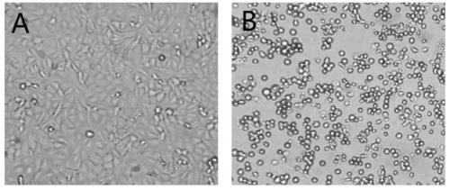 Bivalent freeze-dried egg yolk antibody for infectious feline rhinitis-conjunctivitis and feline panleukopenia and preparation and application thereof