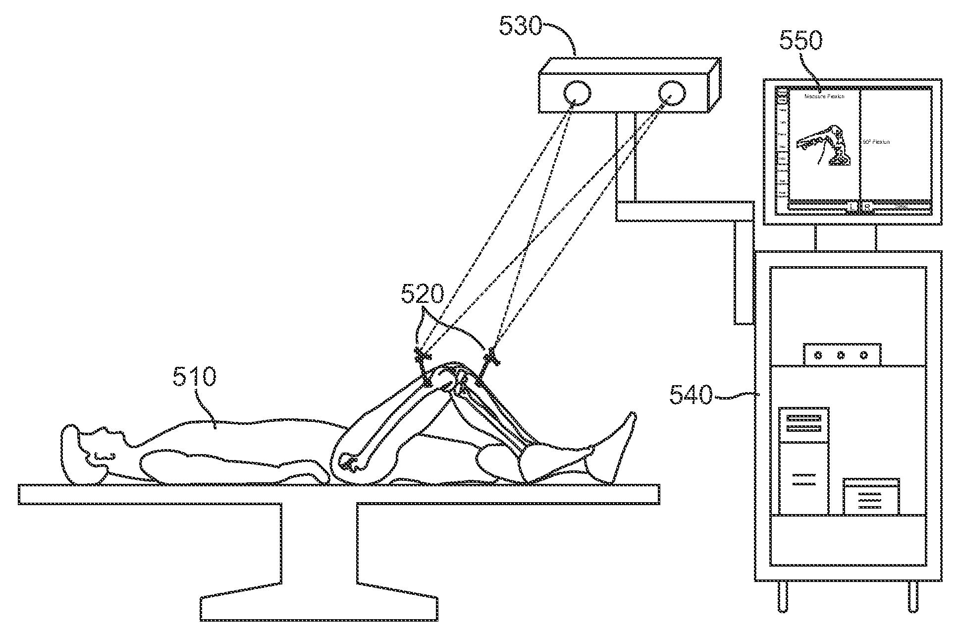 Method for improved rotational alignment in joint arthroplasty