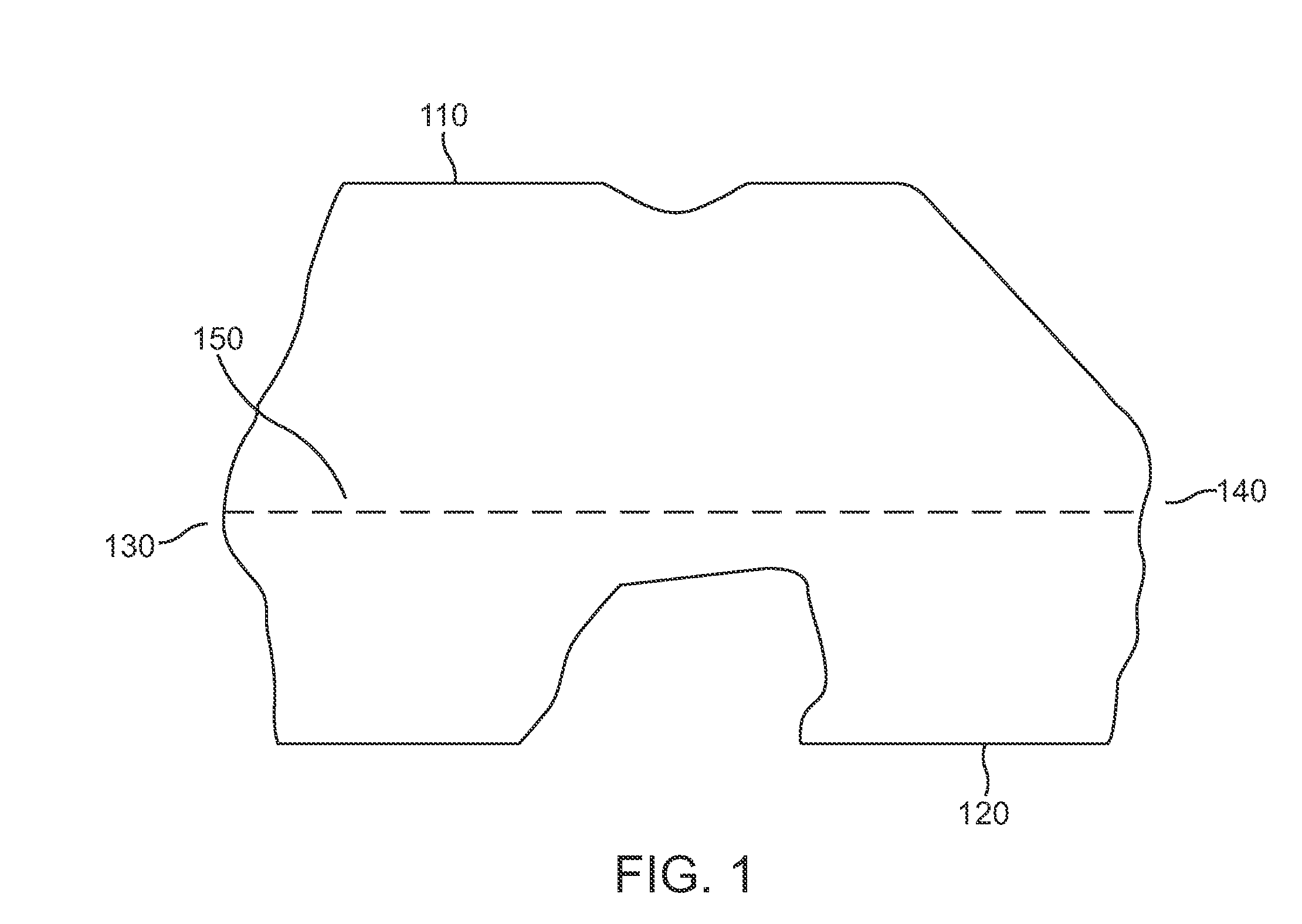 Method for improved rotational alignment in joint arthroplasty