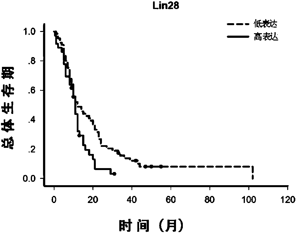 A protein combination used for assessing glioblastoma prognosis and applications thereof