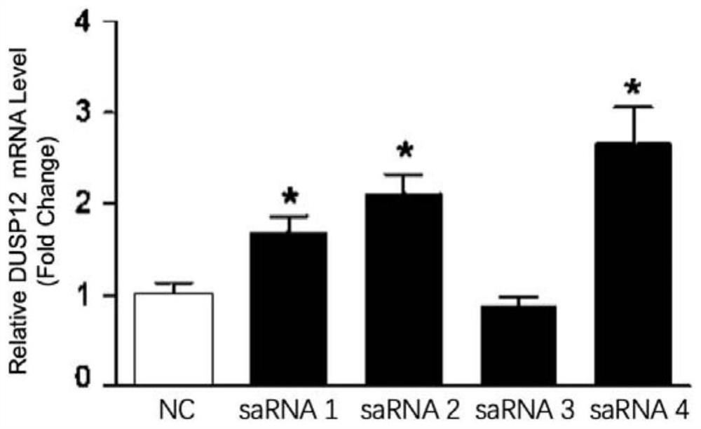 SaRNA for protecting myocardial cells from stress injury and application thereof