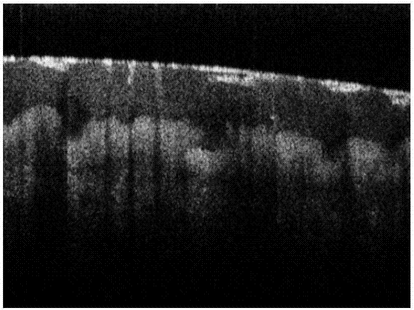 Three-dimensional visualization method and system of OCT (optical coherence tomography) images