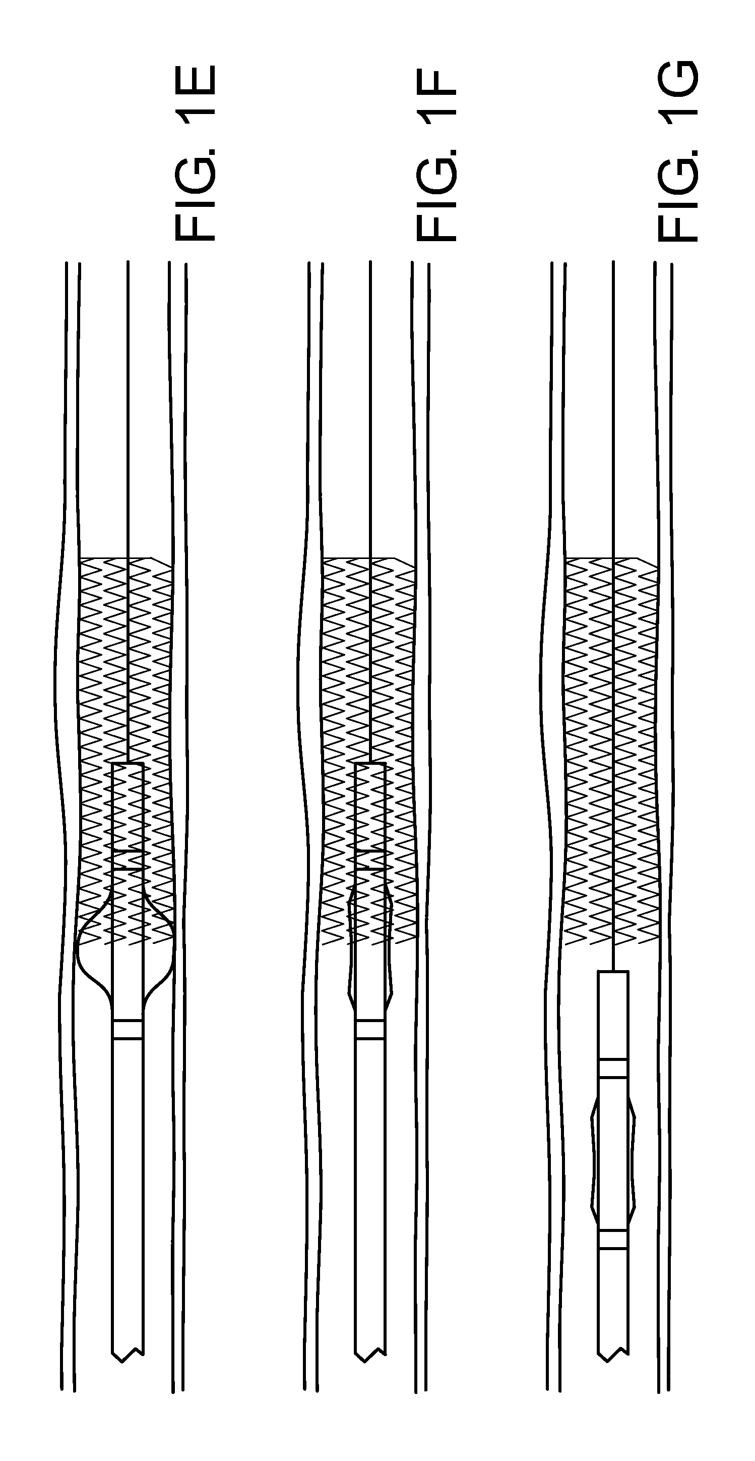 Conformable vascular prosthesis delivery system