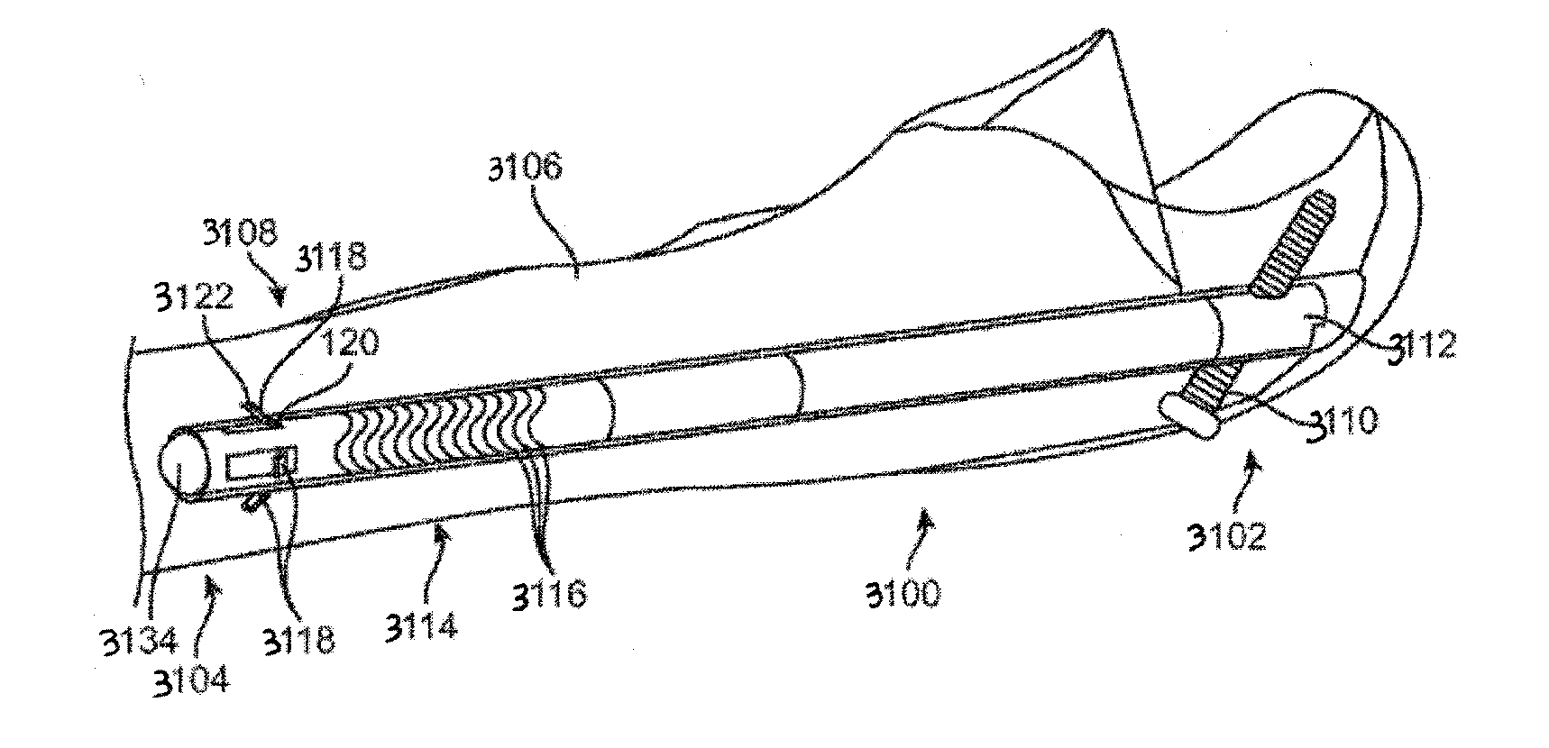 Straight intramedullary fracture fixation devices and methods
