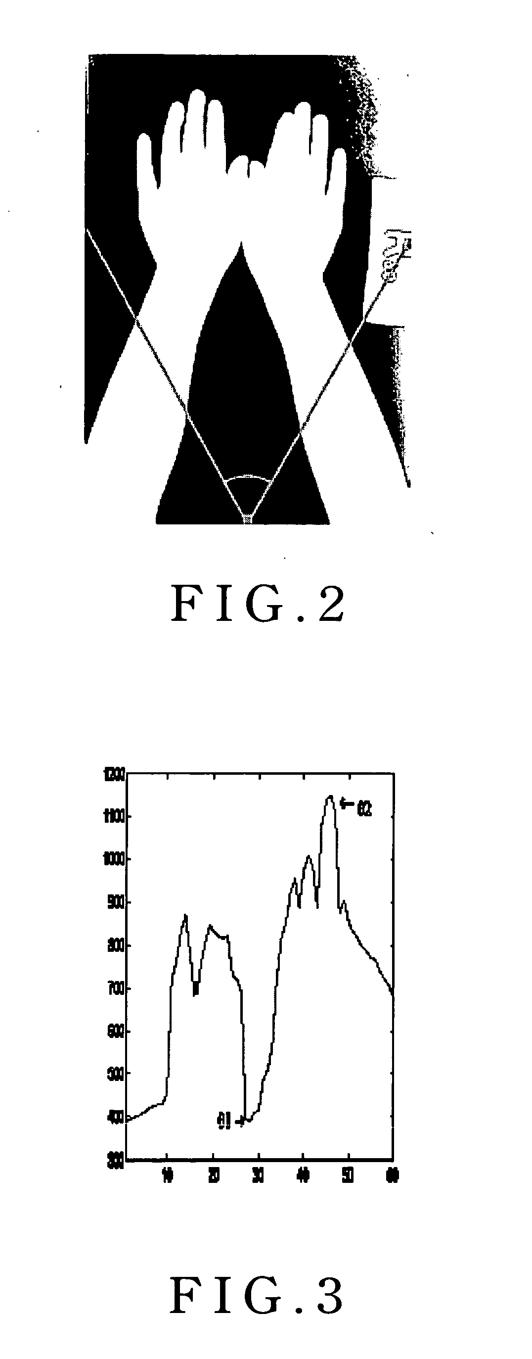Method of automatically assessing skeletal age of hand radiographs