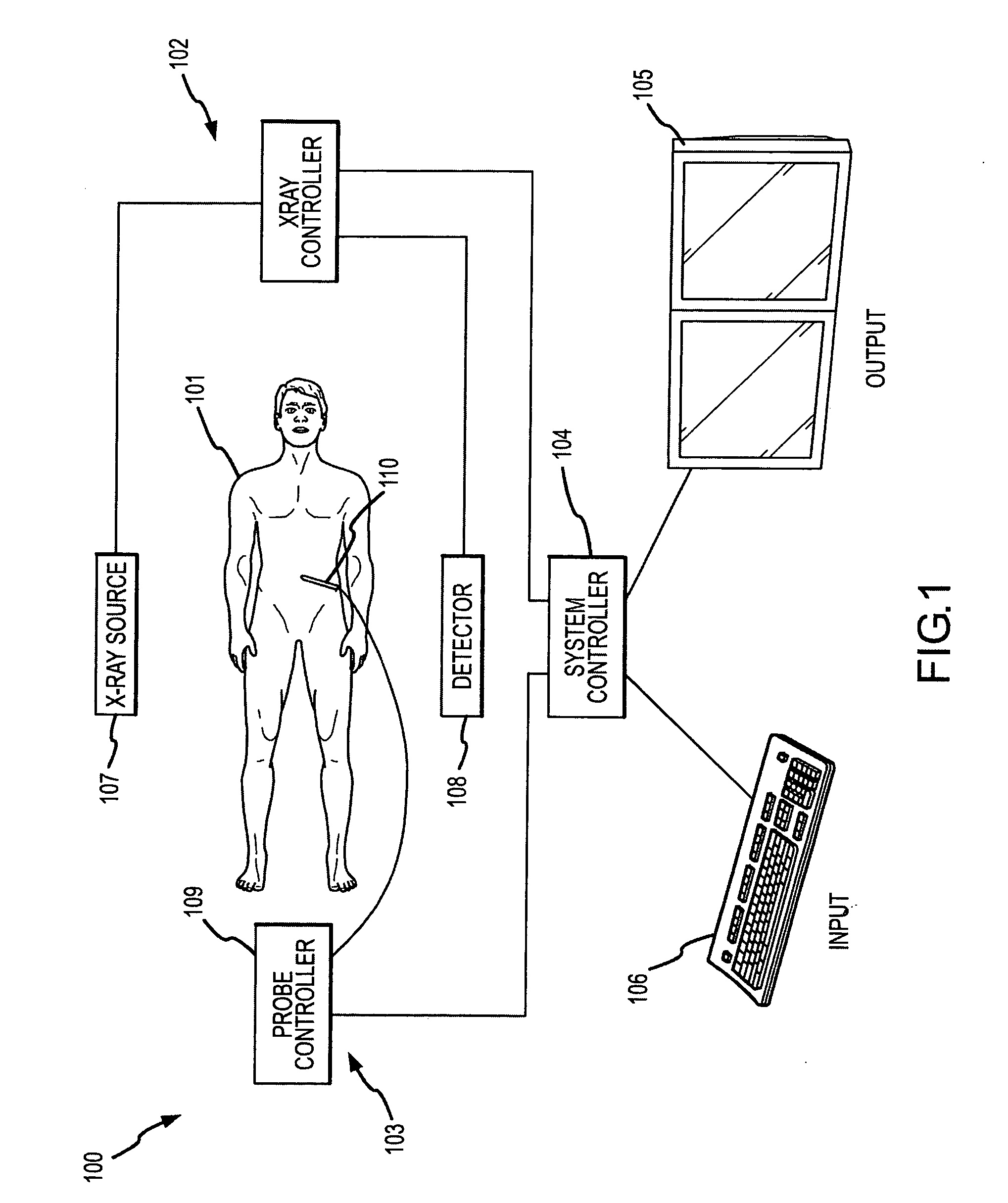 Method for planning, performing and monitoring thermal ablation