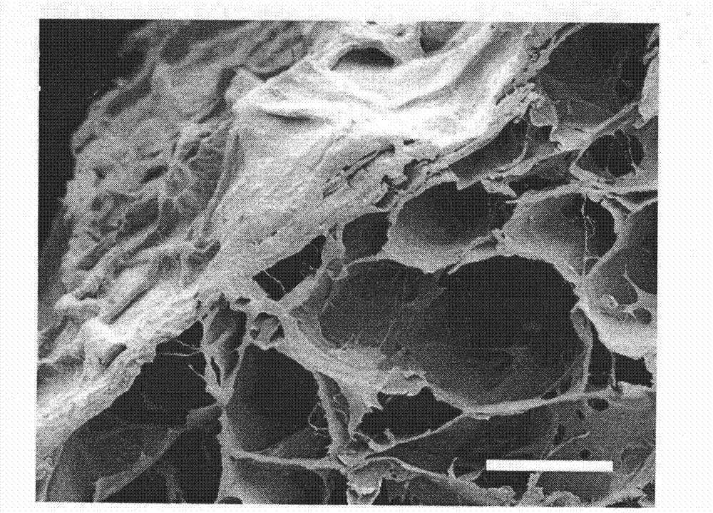High-artificial tissue engineering nerve repair material NGCS and preparation method thereof