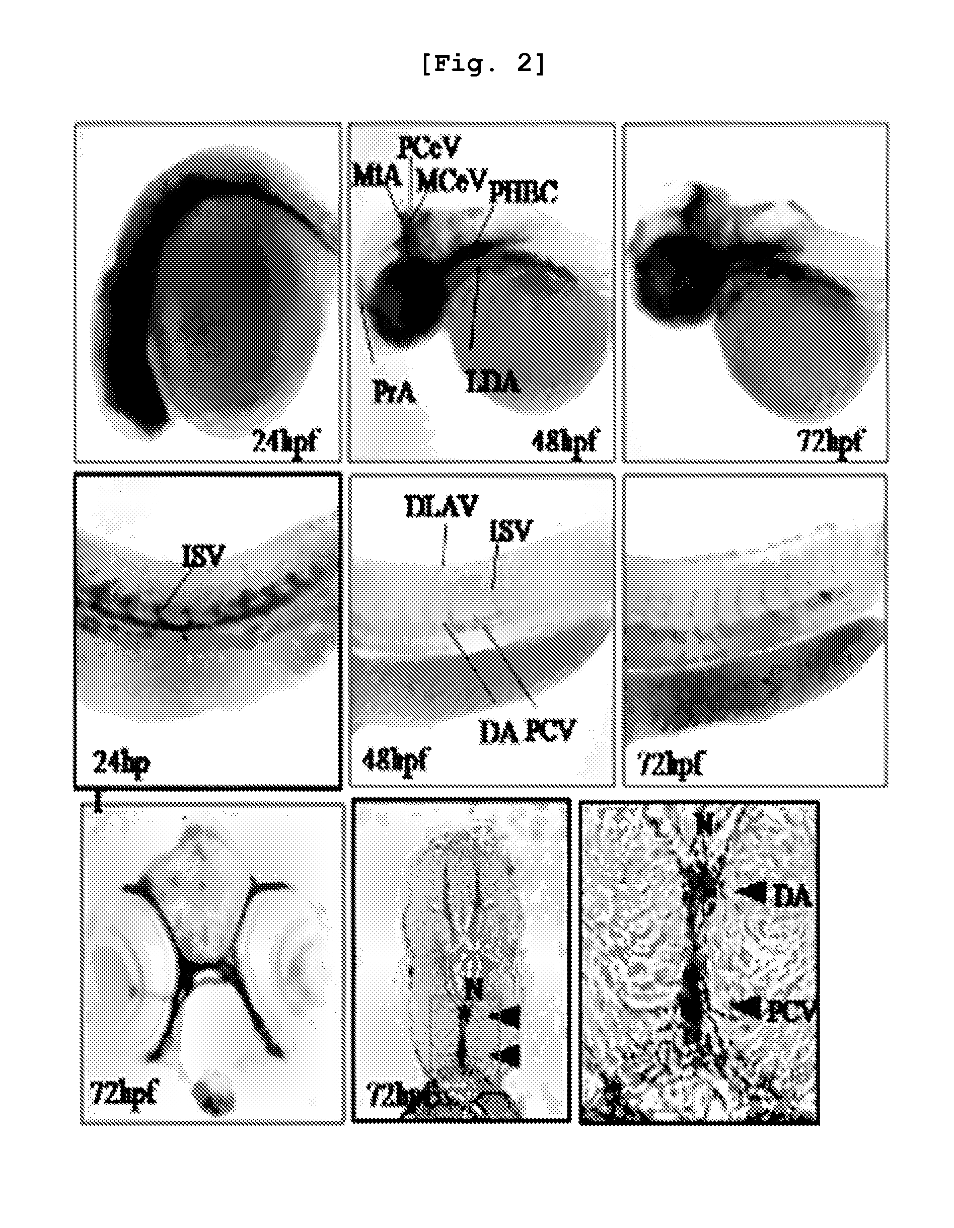 Composition comprised of akap12 and uses of akap12 mutant zebrafish as an animal model