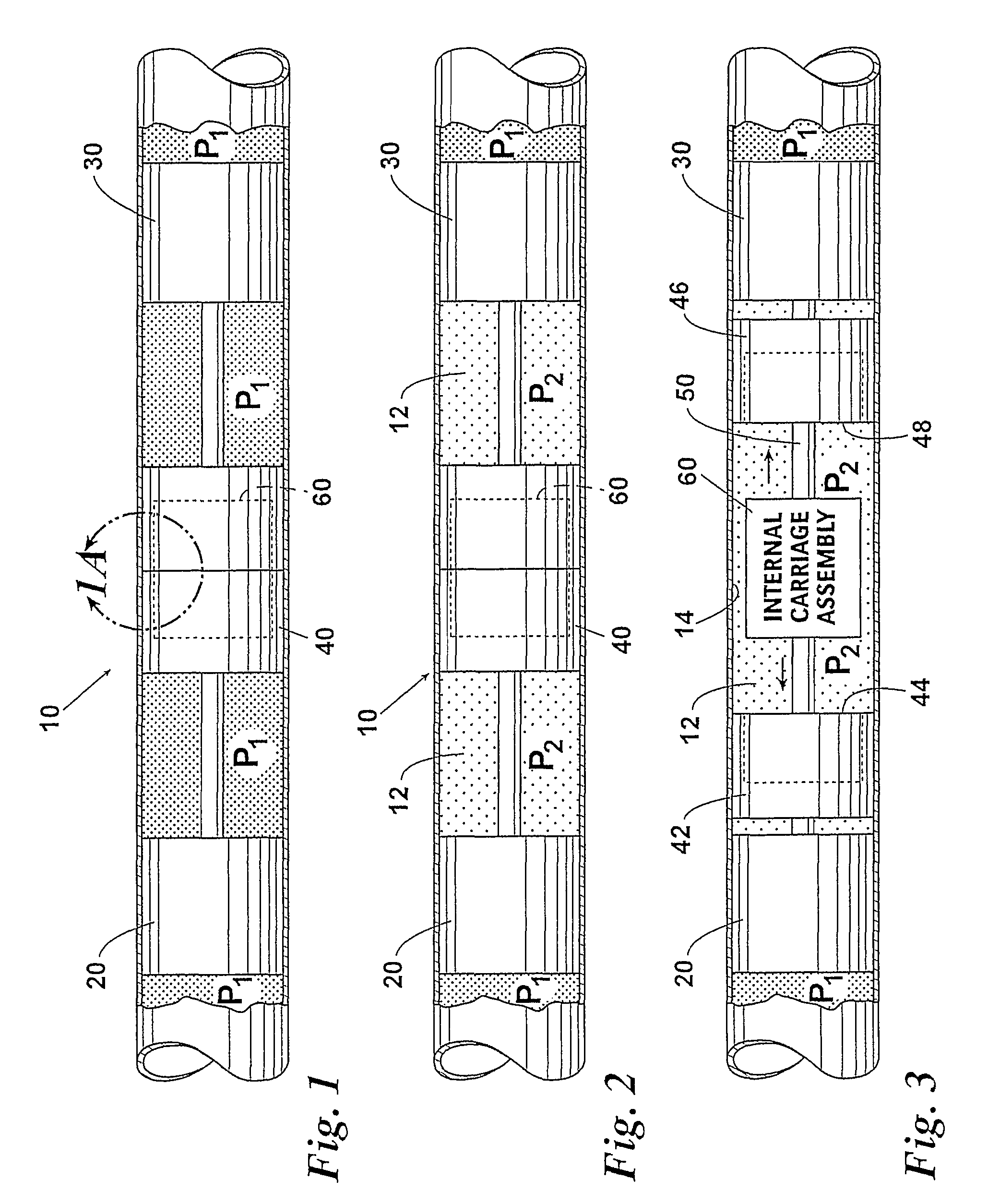 Internal composite repair apparatus