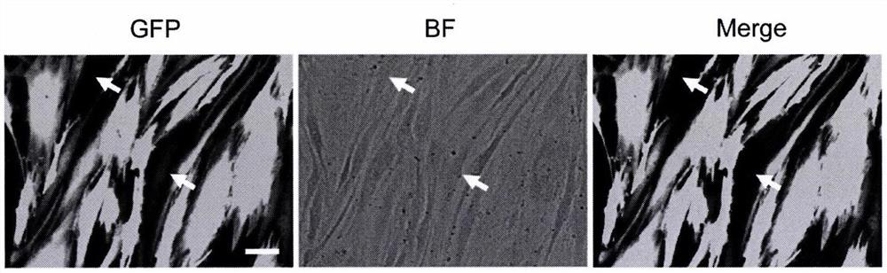 A method for producing age-preserving basal forebrain cholinergic neurons from non-neuronal transformation