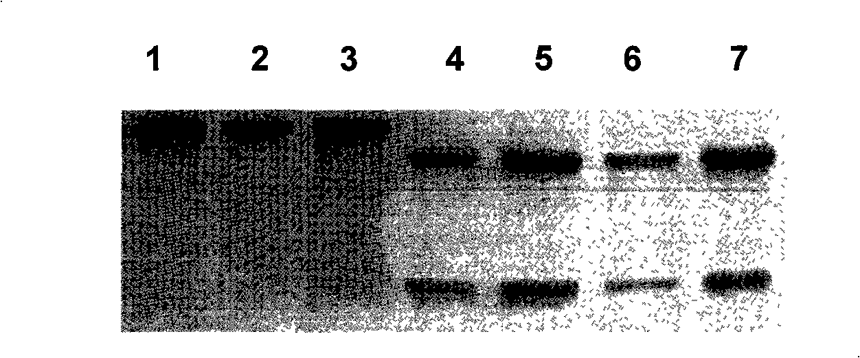 Monoclone antibody of ARD1 and application thereof