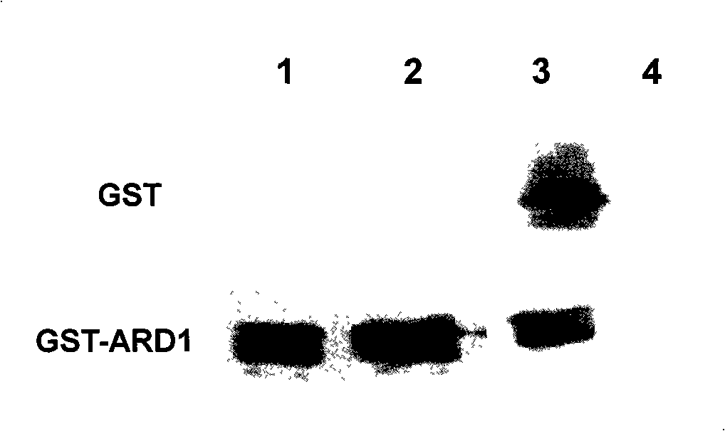 Monoclone antibody of ARD1 and application thereof