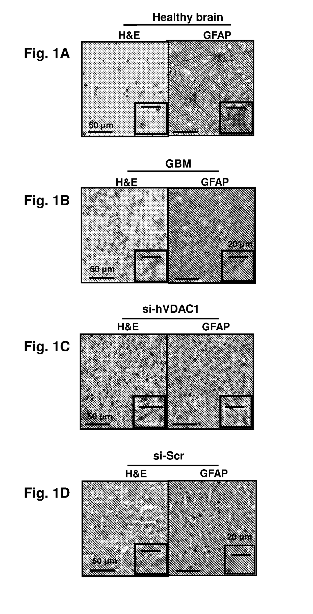 Means and methods for reducing tumorigenicity of cancer stem cells